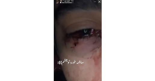 صدای مادرش از آن سوی خط میآید: «بگو یازده ساچمه خورد توی بدنم.» و خودش ادامه میدهد: «یازده ساچمه خورد. یکی مستقیم توی چشمم.» صدای مادرش از آن سوی خط میآید: «بگو یازده ساچمه خورد توی بدنم.» و خودش ادامه میدهد: «یازده ساچمه خورد. یکی مستقیم توی چشمم.»